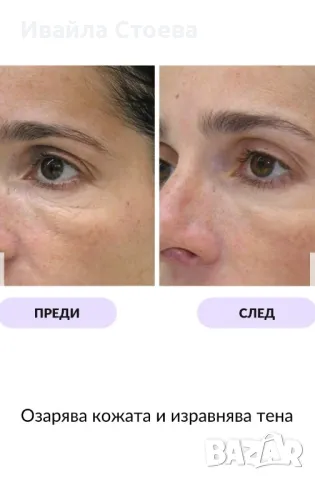 LED Маска за лице - Lumina Glow, снимка 7 - Козметични уреди - 50280678