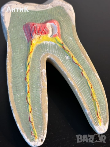 Соц Учебен Модел на Зъб Разрез, снимка 4 - Антикварни и старинни предмети - 53958476
