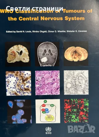 World Classification of Tumours of The Central Nervous System