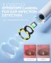 ScopeAround Камера за уши с отоскоп, за отстраняване на ушна кал, съвместим с iPhone 15/ Android, снимка 3