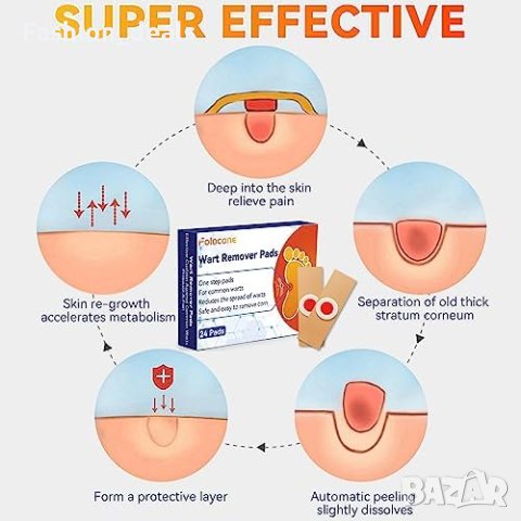Нови 24 броя Пластири за отстраняване на брадавици лечение ръце крака , снимка 4 - Други - 42182488