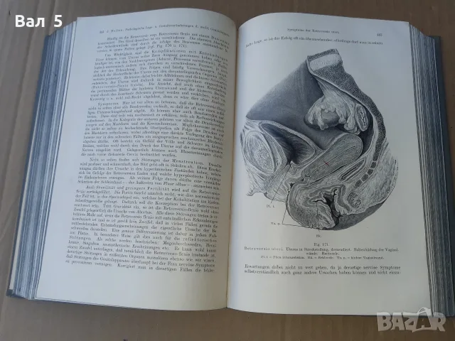 Стар учебник ГИНЕКОЛОГИЯ 1913 г - 802 страници. РЯДЪК !!!, снимка 6 - Специализирана литература - 55991916