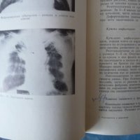 Рентгенология и радиология рентген диагностика кости вътрешни органи, снимка 3 - Специализирана литература - 40730017