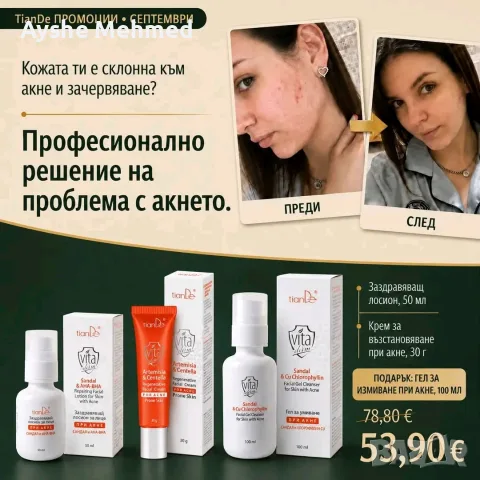 VITA DERM: ПРОФЕСИОНАЛНО РЕШЕНИЕ ЗА ПРОБЛЕМНАТА КОЖА С АКНЕ 