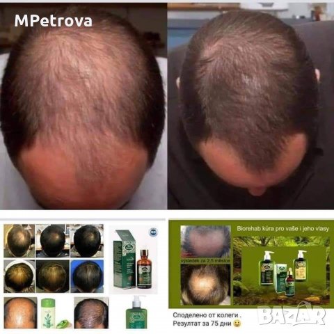 Шампоан за бърз растеж на косата, снимка 4 - Продукти за коса - 34255200