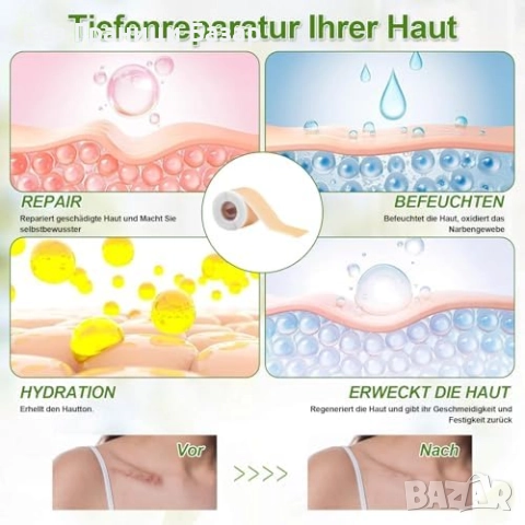 Нов Силиконов комплект за белези – лента и лепенки 4x15см, 4x150см, снимка 3 - Други - 52134678