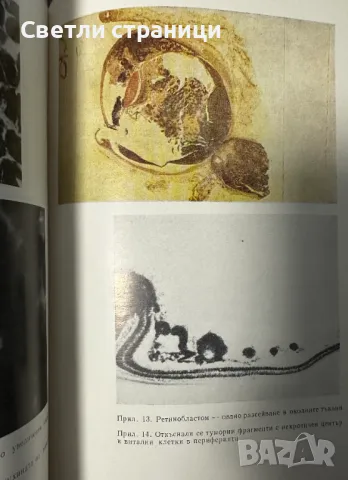 Ретинобластом - Стоимен Дъбов, снимка 4 - Специализирана литература - 48270230