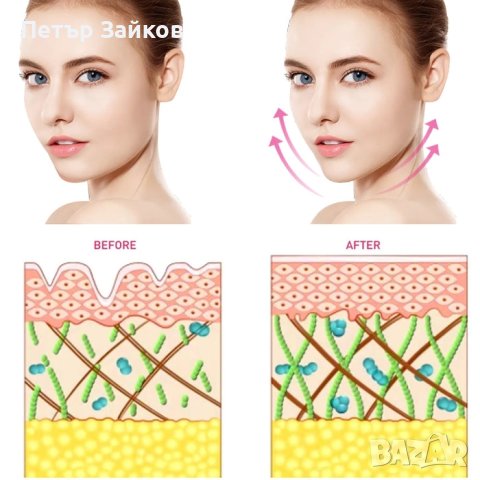 Лифтинг ролков масажор, снимка 5 - Масажори - 42287488