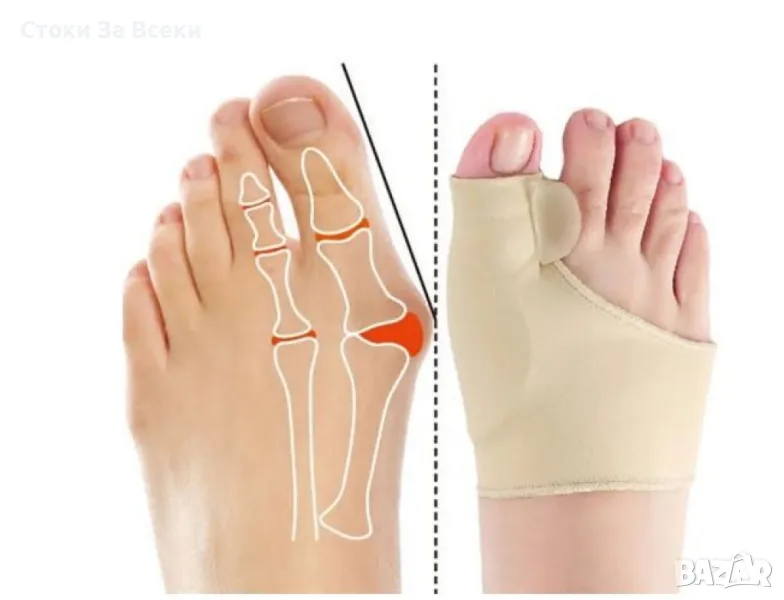 Ортопедични чорапи за коригиране на палеца – Решение при халукс валгус и болки в ходилата, снимка 1