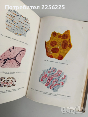 Обща патология и патологическа анатомия, снимка 8 - Специализирана литература - 54183875
