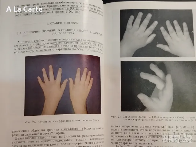 Ювенилен Хроничен Арттрит, снимка 4 - Специализирана литература - 48025015