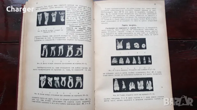 Ръководство по зъбни болести - 1938 год., снимка 11 - Антикварни и старинни предмети - 48920826