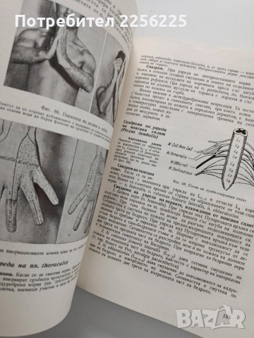 Неврология, снимка 2 - Специализирана литература - 54031163