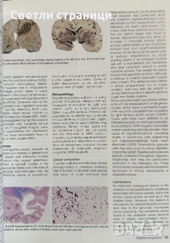 World Classification of Tumours of The Central Nervous System, снимка 2 - Специализирана литература - 48316593