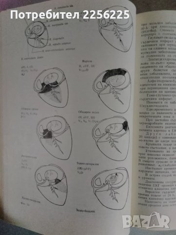 Клинична кардиология , снимка 3 - Специализирана литература - 47395130