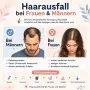 Спрей серум против косопад и за растеж на косата MEN LAB (60 ml) + Дерма ролер, снимка 2